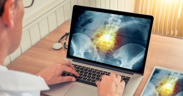 Osteoporosis: Are You at Risk?