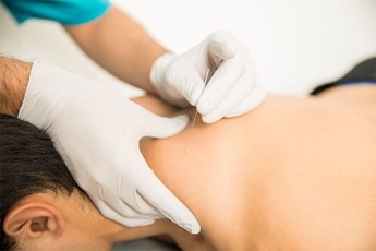 How Does Dry Needling Differ from Acupuncture?
