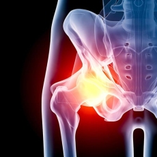 Benefits of Outpatient Joint Replacement