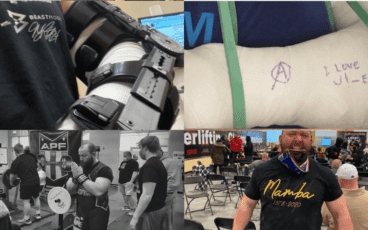 Distal Tendon Biceps Rupture Speedy Recovery: Robert B's Story