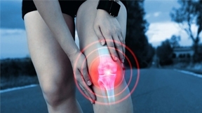 Preventing Arthritis Progression: Arthroscopy and Knee Health