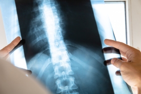 How to Choose a Spine Specialist?A Guide to Finding The Best Care