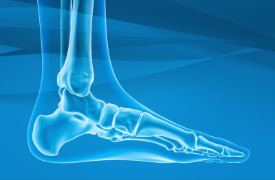 Common Foot and Ankle Injuries