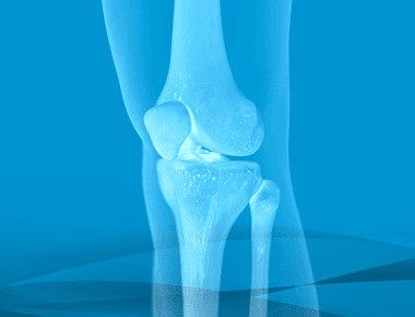 ACL Injuries and Surgery