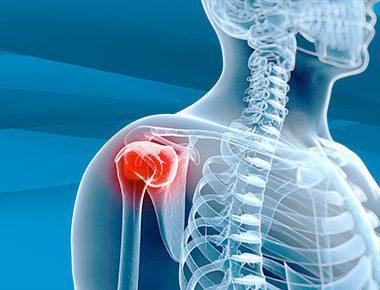 Rotator Cuff Repair