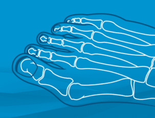 podcast-episode-bunions-1692271891.png