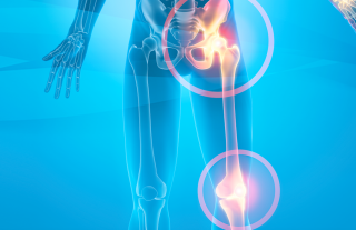 rehab-for-hip-and-knee-arthritis-podcast-1746648798.png