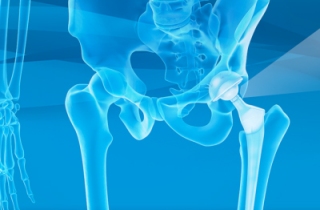 same-day-joint-replacement-surgery-1746646226-1757368210.jpg
