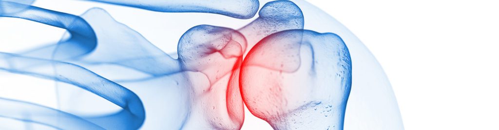 shoulder diagram to show pain in shoulder