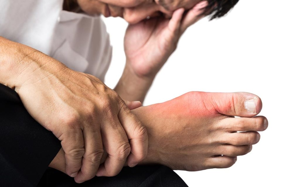 Man clutches foot while experiencing gout pain