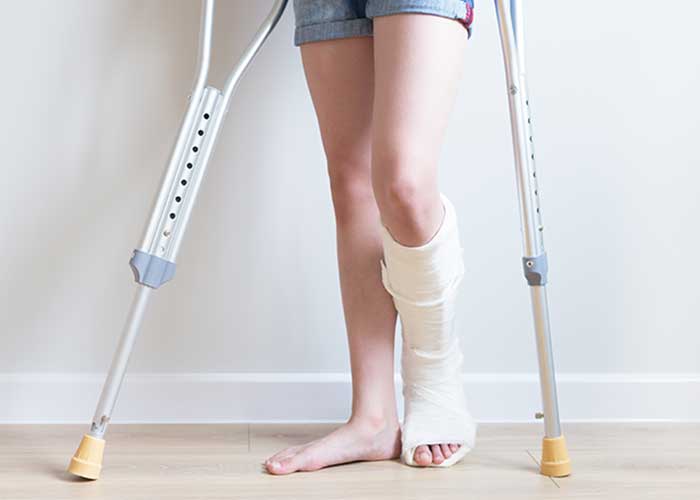 injured ankle on crutches