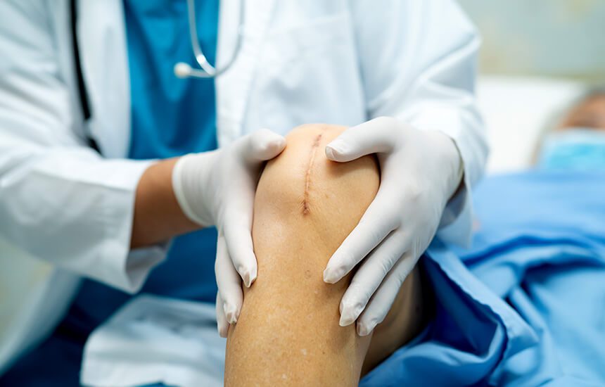 Doctor examining knee after surgery