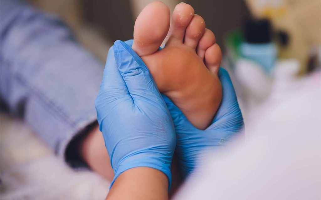 What is Charcot foot?